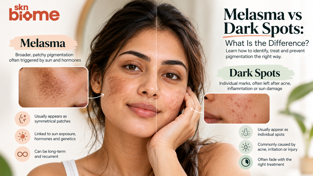 Melasma vs Dark Spots: What Is the Difference?