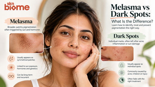 Melasma vs Dark Spots: What Is the Difference?