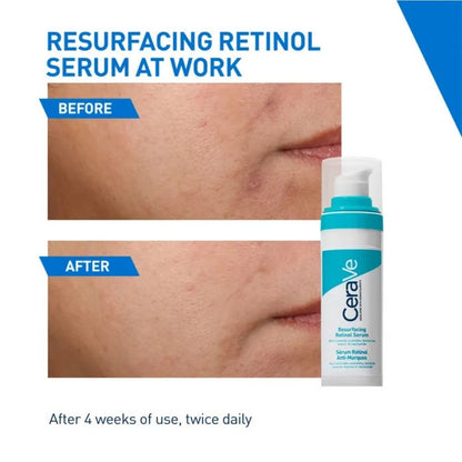 CeraVe Resurfacing Retinol Serum for Acne Marks & Texture – Skn Biome before after 