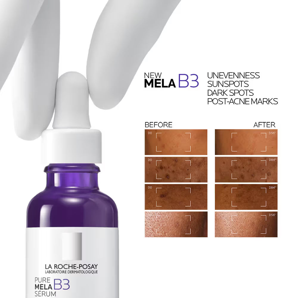La Roche-Posay Mela B3 Serum – Anti-Dark Spots & Pigmentation Care (30ml)